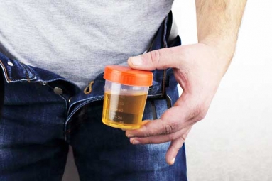 Spotting Blood in Urine can reveal Hidden Kidney Cancer Risks