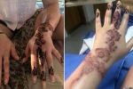 lifestyle, henna tattoo, henna tattoo cause aussie woman to almost lose her hand, Tattoo