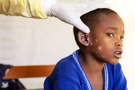 Monkeypox Outbreak, Mpox, is monkeypox outbreak coming to india, Monkey