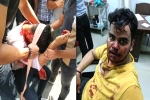 Harsh Yadav attack, Nodia Amity attack, social media demands justice for two noida students who are brutally attacked, Justice for harsh