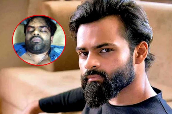 Sai Dharam Tej Injured In A Bike Accident