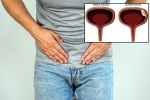 Bladder Cancer articles, Bladder Cancer health checkup, why is bladder cancer common in men, Cancer symptoms
