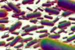 E.coli Outbreak, E.coli Outbreak symptoms, all about e coli outbreak in the united kingdom, E coli outbreak