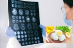 Eggs and Alzheimer’s study, Eggs and Alzheimer’s for health, eggs may help prevent alzheimer s study, Brain health