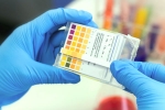 CSIR, technology, everything about feluda a low cost covid 19 test in india, Csir