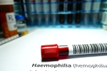 Hemophilia doctors, Hemophilia medication, why are men likely to develop hemophilia, Rises