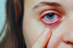 Conjunctivitis videos, Conjunctivitis Telangana, special measures to prevent conjunctivitis, Body organs