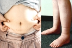 Water Retention problems, Water Retention supplements, some effective ways to reduce water retention, Heart diseases